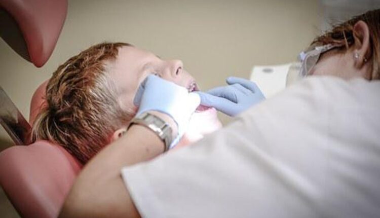 Dental Implants