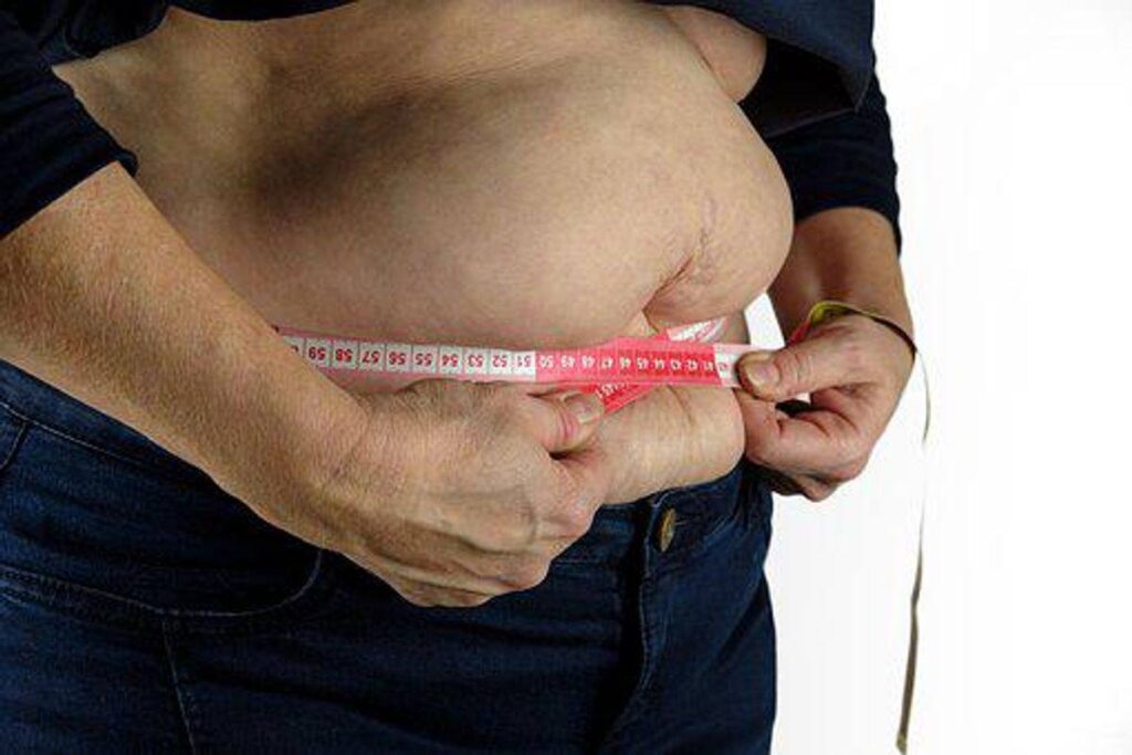Weight Loss and Obesity