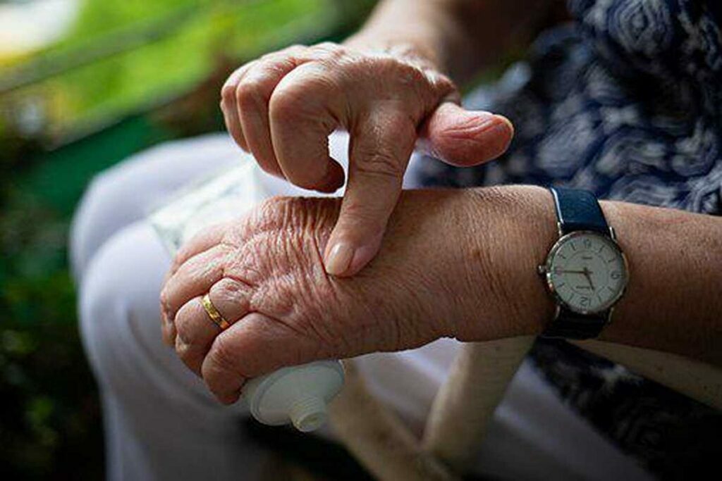 what is arthritis