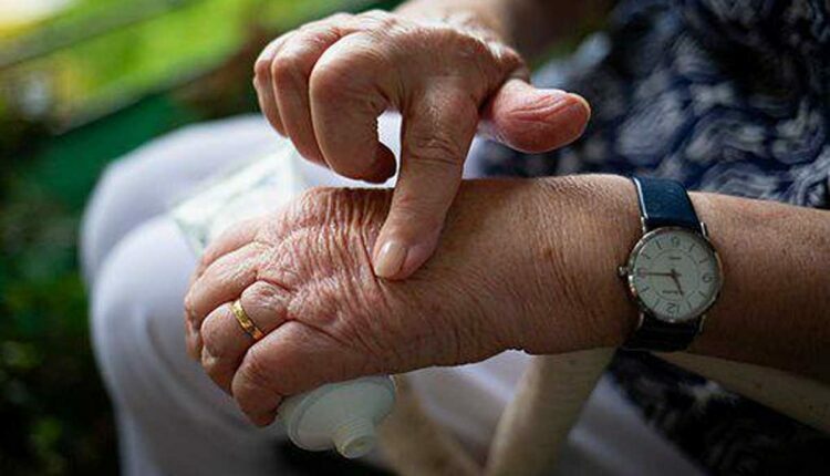 what is arthritis