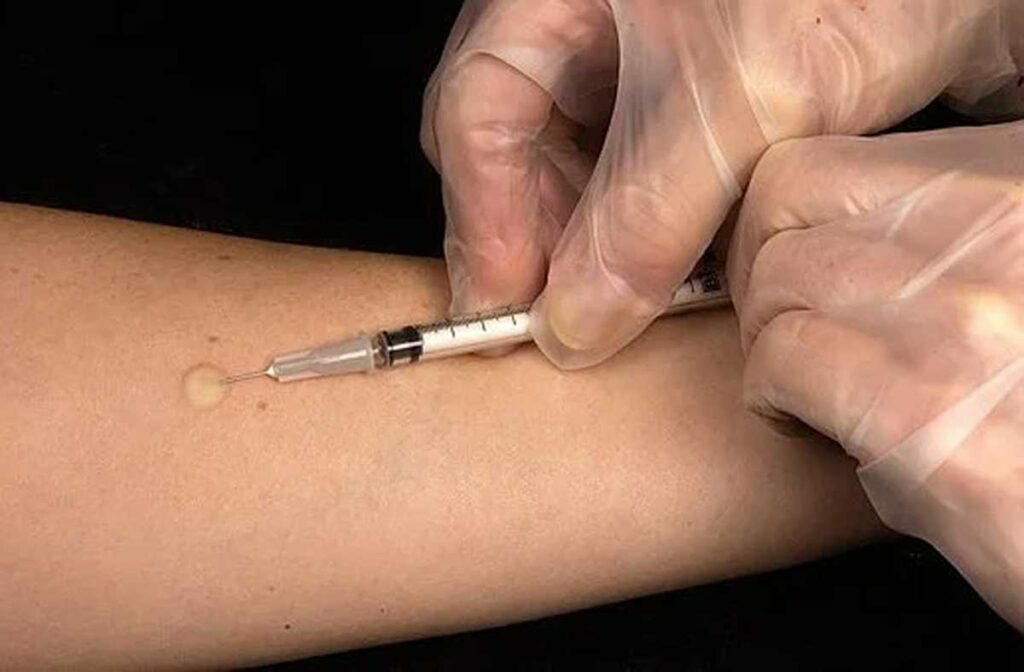 what is tuberculosis