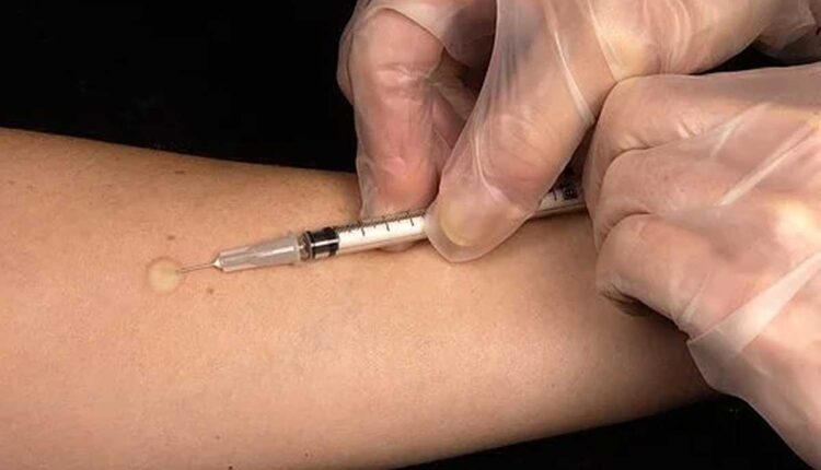 what is tuberculosis