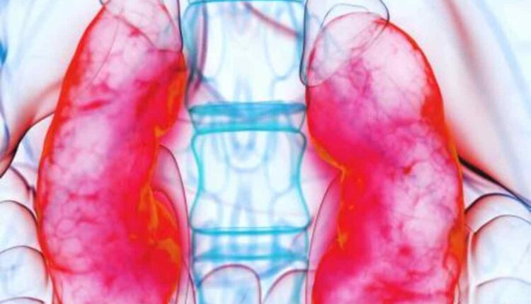 kidney infection symptoms