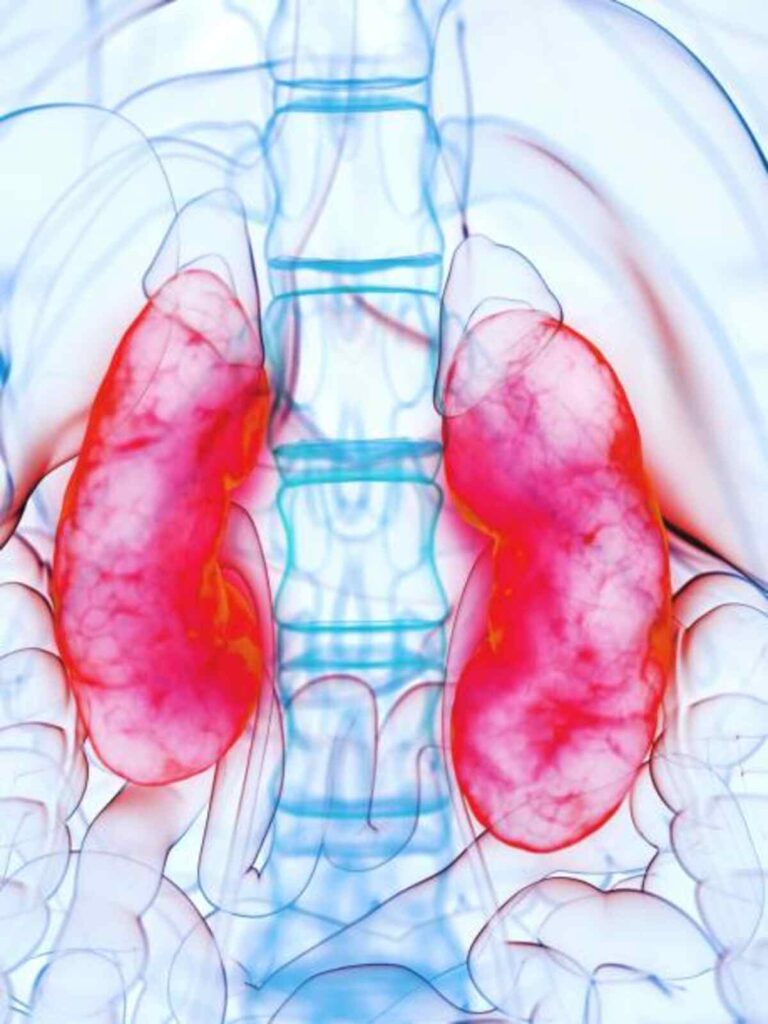 kidney infection symptoms