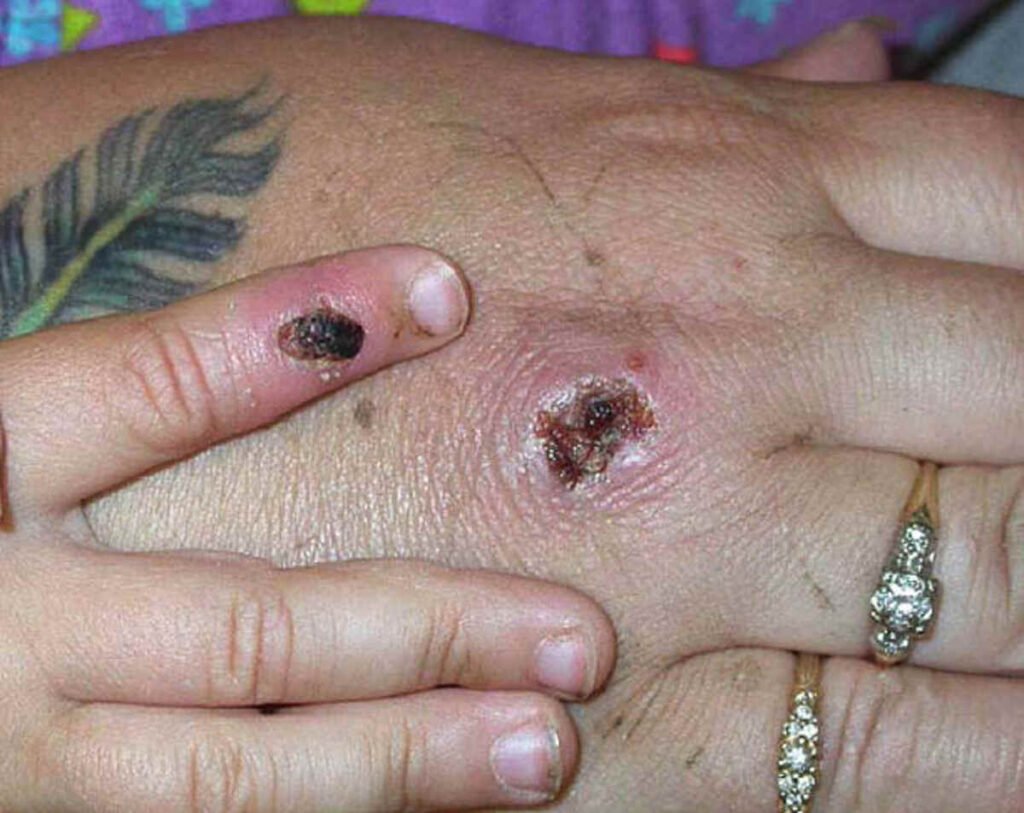 mono symptoms