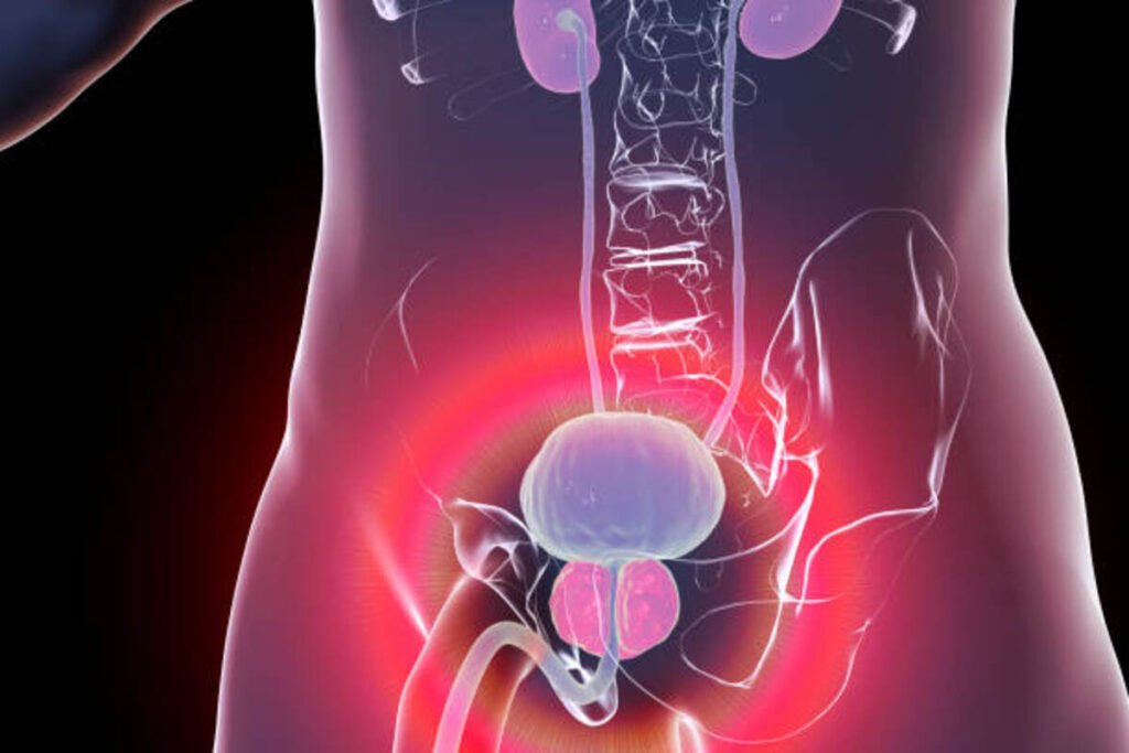 prostate cancer symptoms