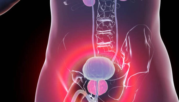 prostate cancer symptoms