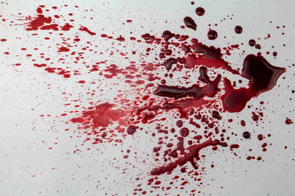 how to get blood stains out