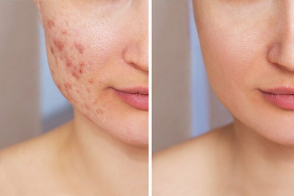 osmosis skincare reviews