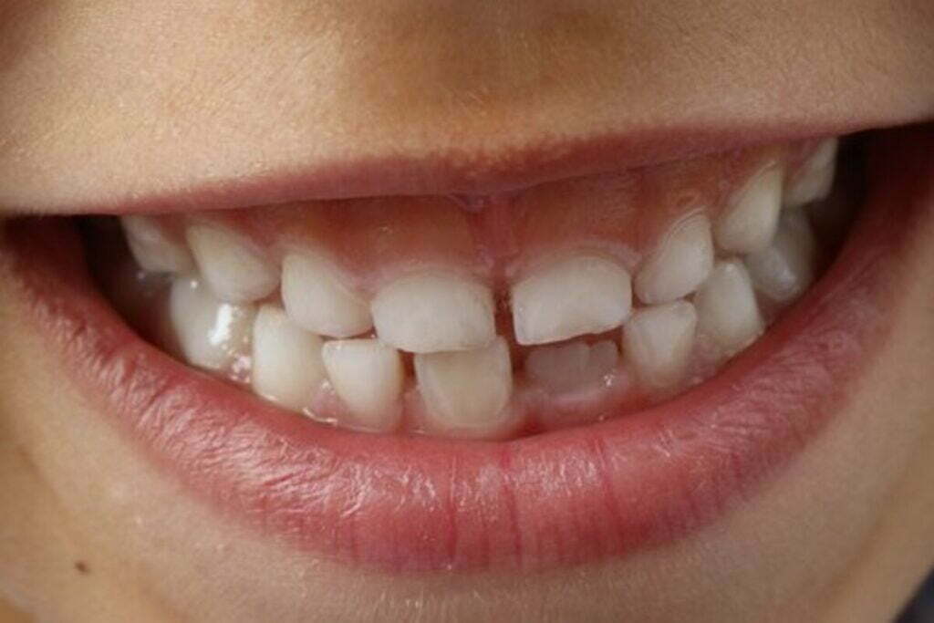 smile dental reviews