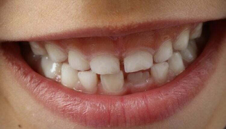 smile dental reviews